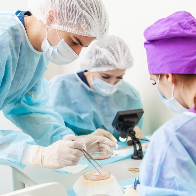 Transplantácia vlasov