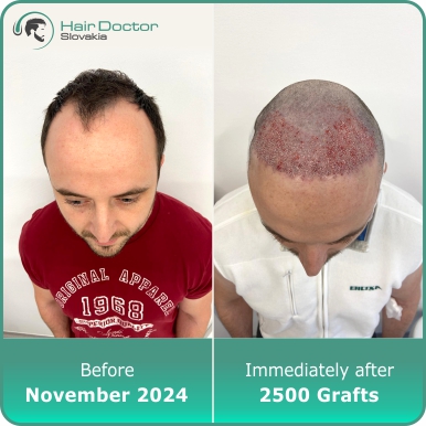 Peter, 36y., Slovakia