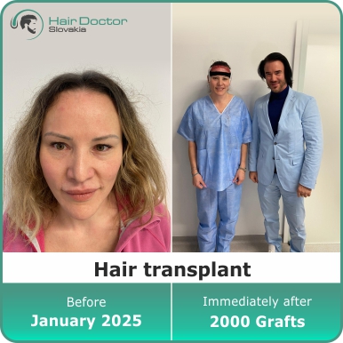 Hair transplant, Slovakia