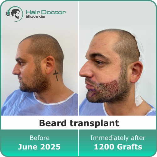 Mr. Vladimír, Slovakia