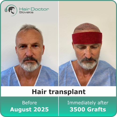 Mr. Leonard, Slovakia