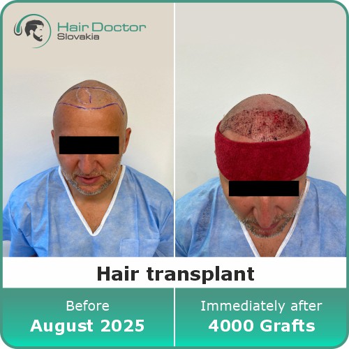 Mr. Miroslav, Slovakia