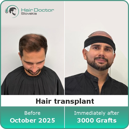 Mr. Marián, Slovakia