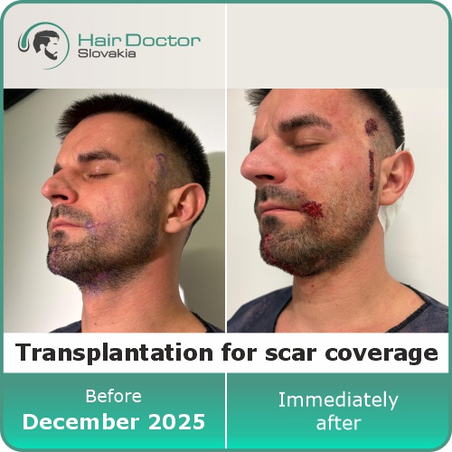 Mr. Michal, Slovakia