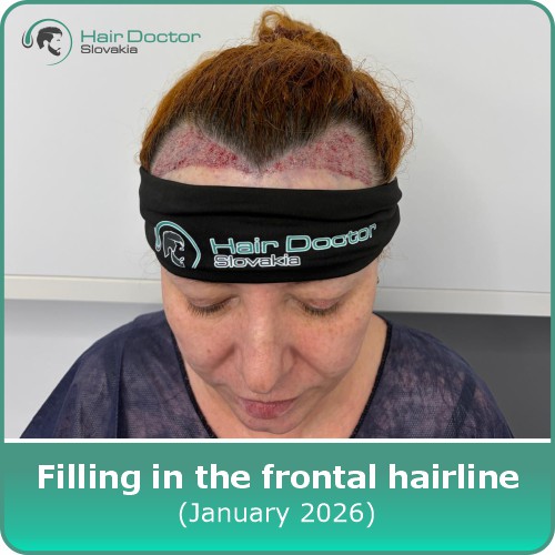 Ms. Lýdia, Slovakia