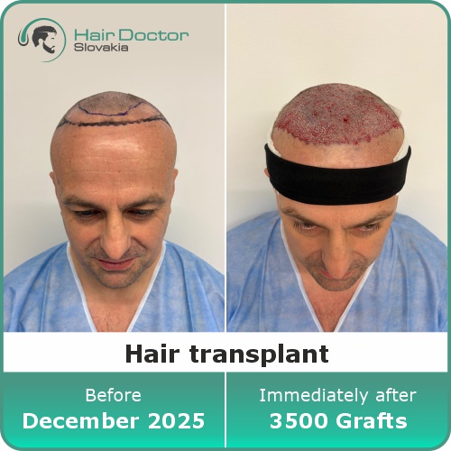 Mr. Zoltán, Slovakia