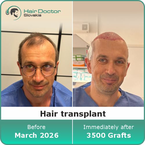 Mr. Ľuboš, Slovakia